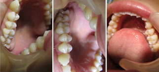 The full cleaning and sterilisation process is explained below