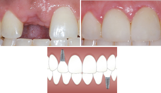 The full cleaning and sterilisation process is explained below